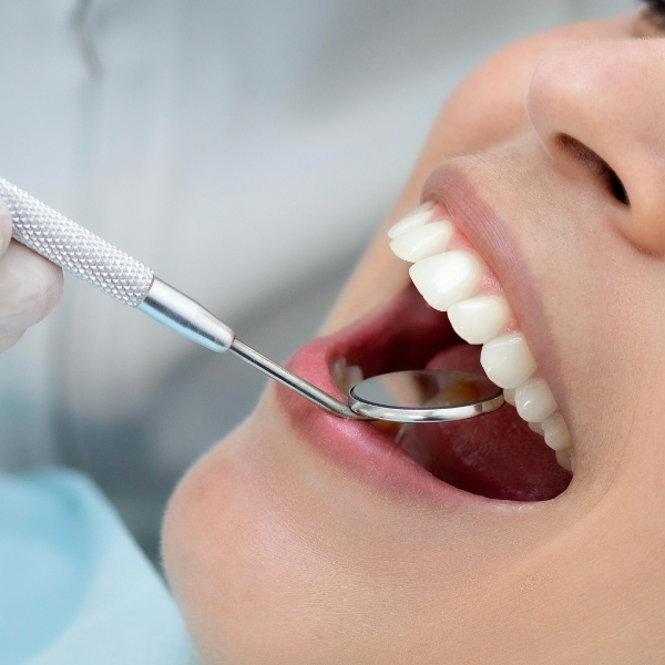 dental-clue